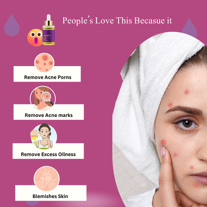 Baspari Niacinamide Acid Serum 4% with Vitamin C Serum 1% -   for Glowing Skin | Helps Reduce Dullness & Sun Damage | For Dry & Sensitive Skin | 30ml